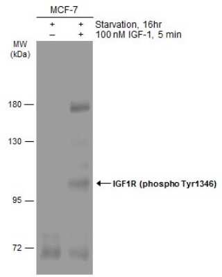 Western Blot: IGF-I R/IGF1R [p Tyr1316] Antibody [NBP3-13234]